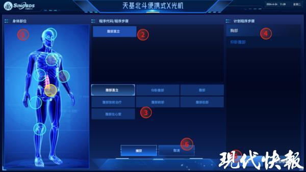 江苏便携式X光机“随手拍”北斗赋能移动诊疗让公共数据“跑起来”(图2)